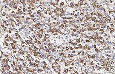 Anti-GFAP antibody [HL1307] used in IHC (Paraffin sections) (IHC-P). GTX636725