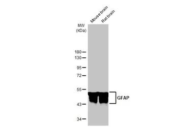 Anti-GFAP antibody [HL1307] used in Western Blot (WB). GTX636725