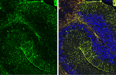 Anti-GFAP antibody [HL1307] used in IHC (Paraffin sections) (IHC-P). GTX636725