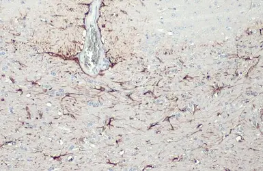 Anti-GFAP antibody [HL1307] used in IHC (Paraffin sections) (IHC-P). GTX636725