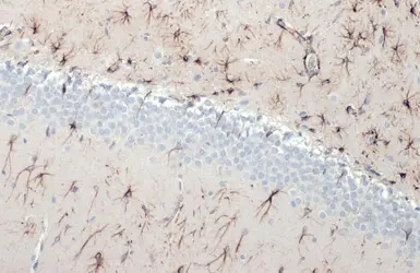 Anti-GFAP antibody [HL1307] used in IHC (Paraffin sections) (IHC-P). GTX636725