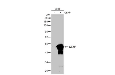 Anti-GFAP antibody [HL1307] used in Western Blot (WB). GTX636725