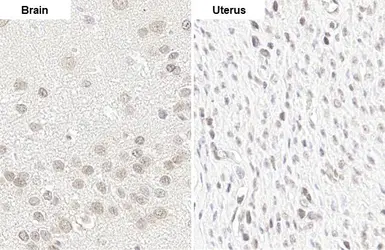 Anti-YTHDF2 antibody [HL1354] used in IHC (Paraffin sections) (IHC-P). GTX636774