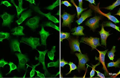 Anti-YTHDF2 antibody [HL1354] used in Immunocytochemistry/ Immunofluorescence (ICC/IF). GTX636774