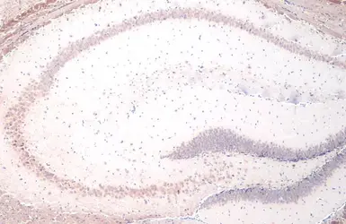 Anti-YTHDF2 antibody [HL1354] used in IHC (Paraffin sections) (IHC-P). GTX636774