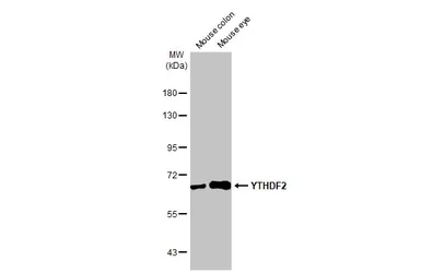 Anti-YTHDF2 antibody [HL1354] used in Western Blot (WB). GTX636774