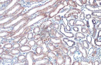 Anti-StAR antibody [HL1360] used in IHC (Paraffin sections) (IHC-P). GTX636800