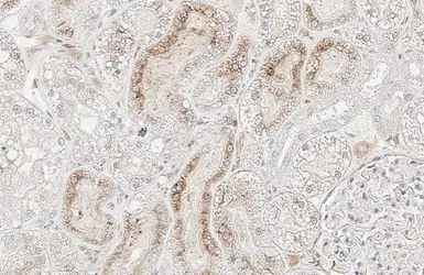 Anti-StAR antibody [HL1360] used in IHC (Paraffin sections) (IHC-P). GTX636800