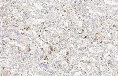 Anti-StAR antibody [HL1360] used in IHC (Paraffin sections) (IHC-P). GTX636800
