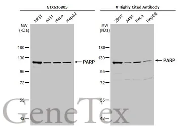 Anti-PARP antibody [HL1365] used in Western Blot (WB). GTX636805