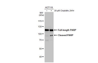 Anti-PARP antibody [HL1365] used in Western Blot (WB). GTX636805