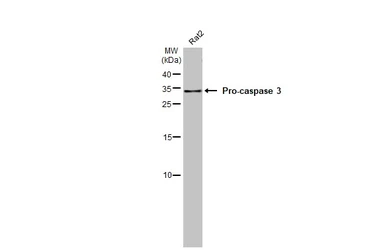 Anti-Caspase 3 antibody [HL1370] used in Western Blot (WB). GTX636810