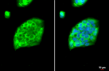 Anti-Fibrinogen gamma antibody [HL1395] used in Immunocytochemistry/ Immunofluorescence (ICC/IF). GTX636835
