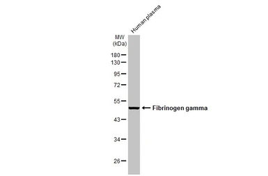 Anti-Fibrinogen gamma antibody [HL1395] used in Western Blot (WB). GTX636835