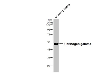 Anti-Fibrinogen gamma antibody [HL1395] used in Western Blot (WB). GTX636835