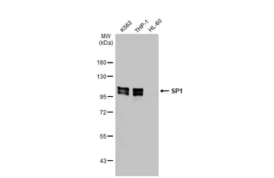 Anti-SP1 antibody [HL1396] used in Western Blot (WB). GTX636836