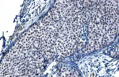 Anti-SP1 antibody [HL1396] used in IHC (Paraffin sections) (IHC-P). GTX636836