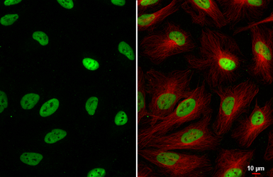 Anti-SP1 antibody [HL1396] used in Immunocytochemistry/ Immunofluorescence (ICC/IF). GTX636836