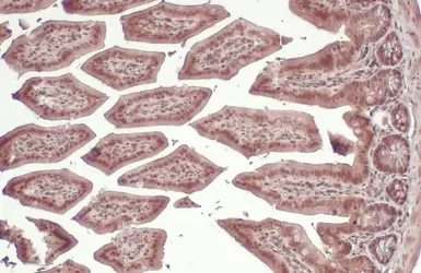 Anti-PI3 kinase p85 alpha antibody [HL1398] used in IHC (Paraffin sections) (IHC-P). GTX636838