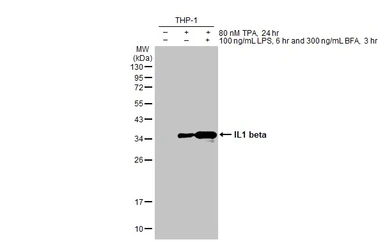 Anti-IL1 beta antibody [HL1421] used in Western Blot (WB). GTX636887