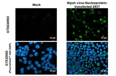 Anti-Nipah virus Nucleoprotein antibody [HL1436] used in Immunocytochemistry/ Immunofluorescence (ICC/IF). GTX636902