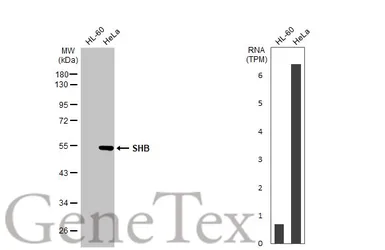 Anti-SHB antibody [HL1455] used in Western Blot (WB). GTX636927