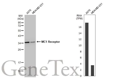 Anti-MC1 Receptor antibody [HL1470] used in Western Blot (WB). GTX636944