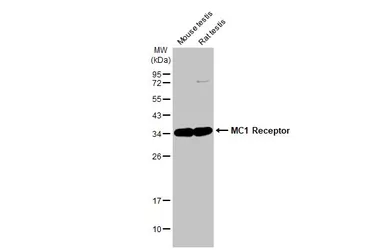 Anti-MC1 Receptor antibody [HL1470] used in Western Blot (WB). GTX636944