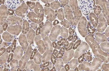 Anti-MC1 Receptor antibody [HL1471] used in IHC (Paraffin sections) (IHC-P). GTX636945