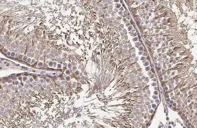 Anti-MC1 Receptor antibody [HL1471] used in IHC (Paraffin sections) (IHC-P). GTX636945