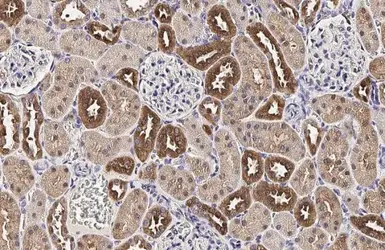 Anti-MC1 Receptor antibody [HL1471] used in IHC (Paraffin sections) (IHC-P). GTX636945