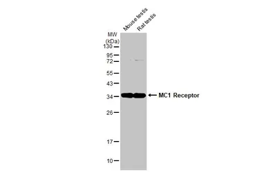Anti-MC1 Receptor antibody [HL1471] used in Western Blot (WB). GTX636945