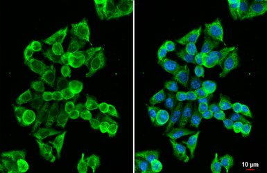 Anti-MC1 Receptor antibody [HL1471] used in Immunocytochemistry/ Immunofluorescence (ICC/IF). GTX636945