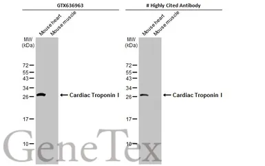 Anti-Cardiac Troponin I antibody [HL1489] used in Western Blot (WB). GTX636963