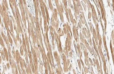 Anti-Cardiac Troponin I antibody [HL1489] used in IHC (Paraffin sections) (IHC-P). GTX636963
