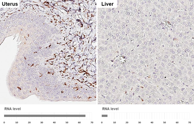 Anti-Vimentin antibody [HL1506] used in IHC (Paraffin sections) (IHC-P). GTX636980