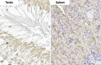 Anti-DNA polymerase beta antibody [HL1512] used in IHC (Paraffin sections) (IHC-P). GTX636986