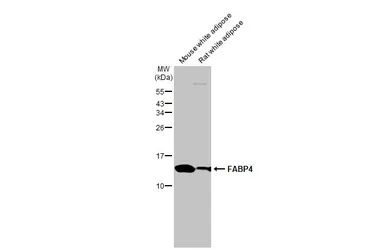 Anti-FABP4 antibody [HL1520] used in Western Blot (WB). GTX636994