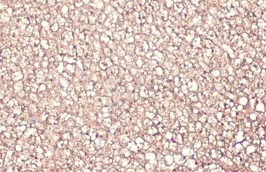 Anti-FABP4 antibody [HL1521] used in IHC (Paraffin sections) (IHC-P). GTX636995