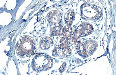 Anti-EpCAM antibody [HL1524] used in IHC (Paraffin sections) (IHC-P). GTX636998