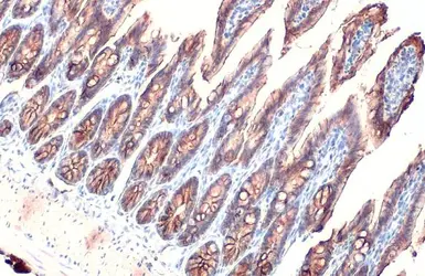 Anti-EpCAM antibody [HL1524] used in IHC (Paraffin sections) (IHC-P). GTX636998