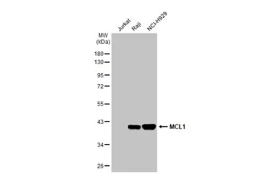 Anti-MCL1 antibody [HL1544] used in Western Blot (WB). GTX637019