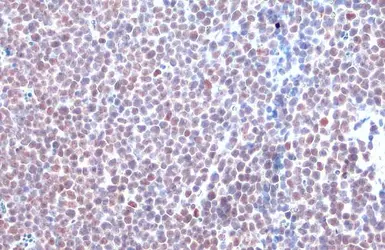 Anti-HDAC2 antibody [HL1545] used in IHC (Paraffin sections) (IHC-P). GTX637020