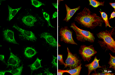 Anti-GRK2 antibody [HL1562] used in Immunocytochemistry/ Immunofluorescence (ICC/IF). GTX637038