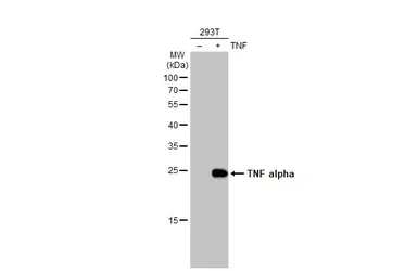 Anti-TNF alpha antibody [HL1579] used in Western Blot (WB). GTX637058
