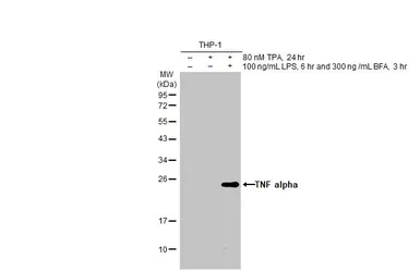 Anti-TNF alpha antibody [HL1579] used in Western Blot (WB). GTX637058