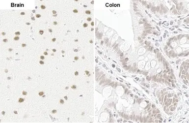 Anti-U2AF65 antibody [HL1583] used in IHC (Paraffin sections) (IHC-P). GTX637062