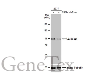 Anti-Calnexin antibody [HL1598] used in Western Blot (WB). GTX637077