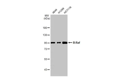 Anti-B-Raf antibody [HL1606] used in Western Blot (WB). GTX637085