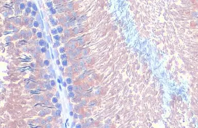 Anti-B-Raf antibody [HL1606] used in IHC (Paraffin sections) (IHC-P). GTX637085